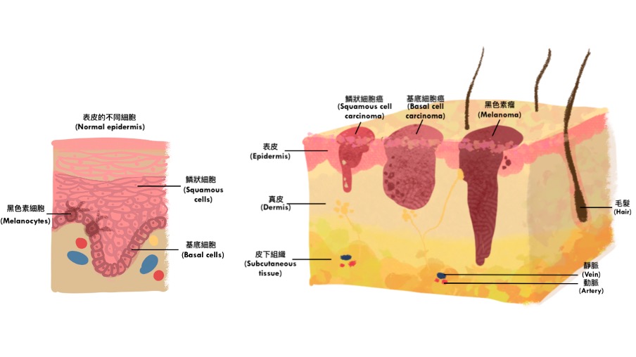 ch9-25-2-p1.jpg